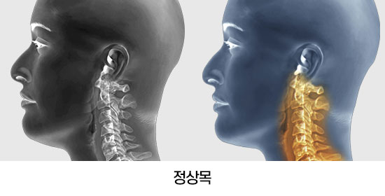 정상목 이미지